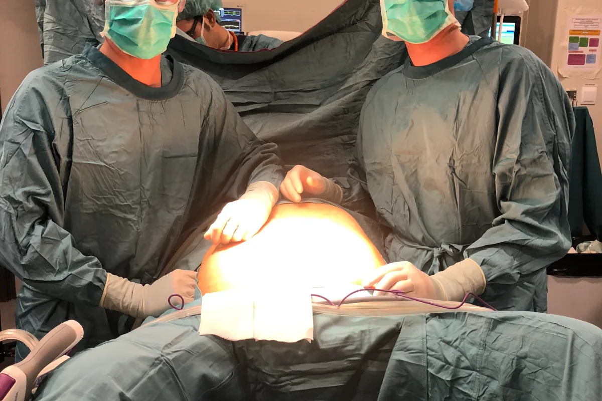 Cirugía de pared abdominal en Barcelona: reparación de hernias con malla