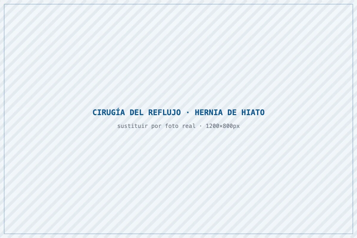 Cirugía del reflujo gastroesofágico y hernia de hiato en Barcelona
