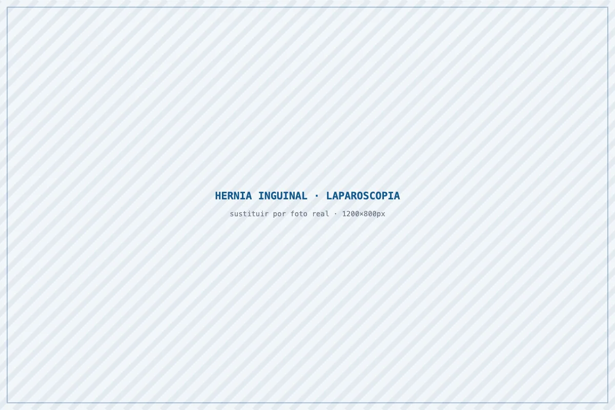 Cirugía de hernia inguinal por laparoscopia TAPP en Barcelona con el Dr. Iván Díaz